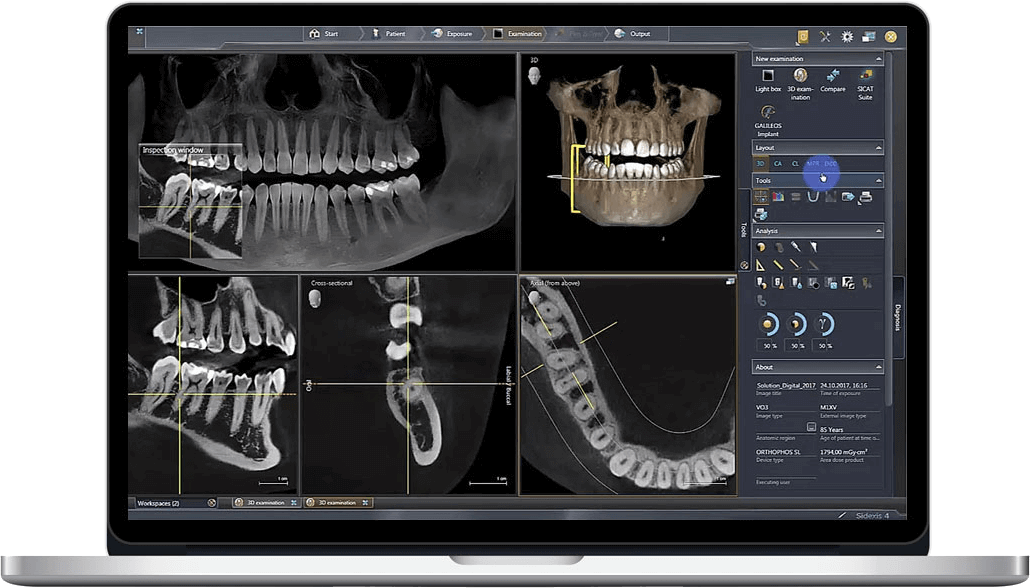 CBCT