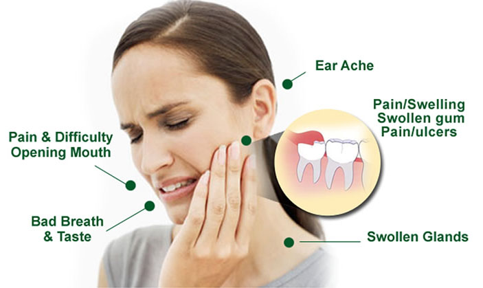 Teeth Extraction in Lahore, Pakistan